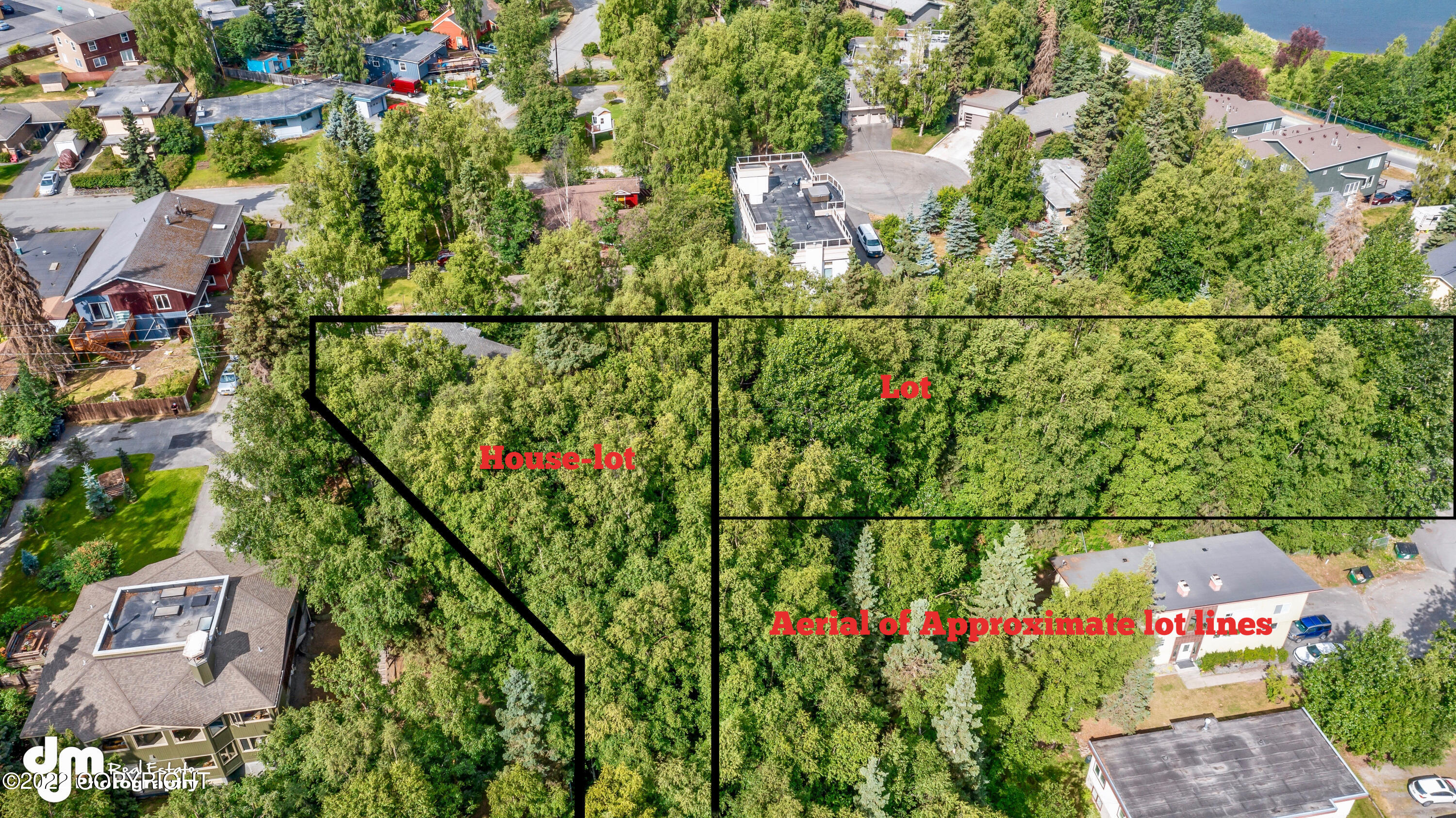 L14A B8B W 20th Avenue