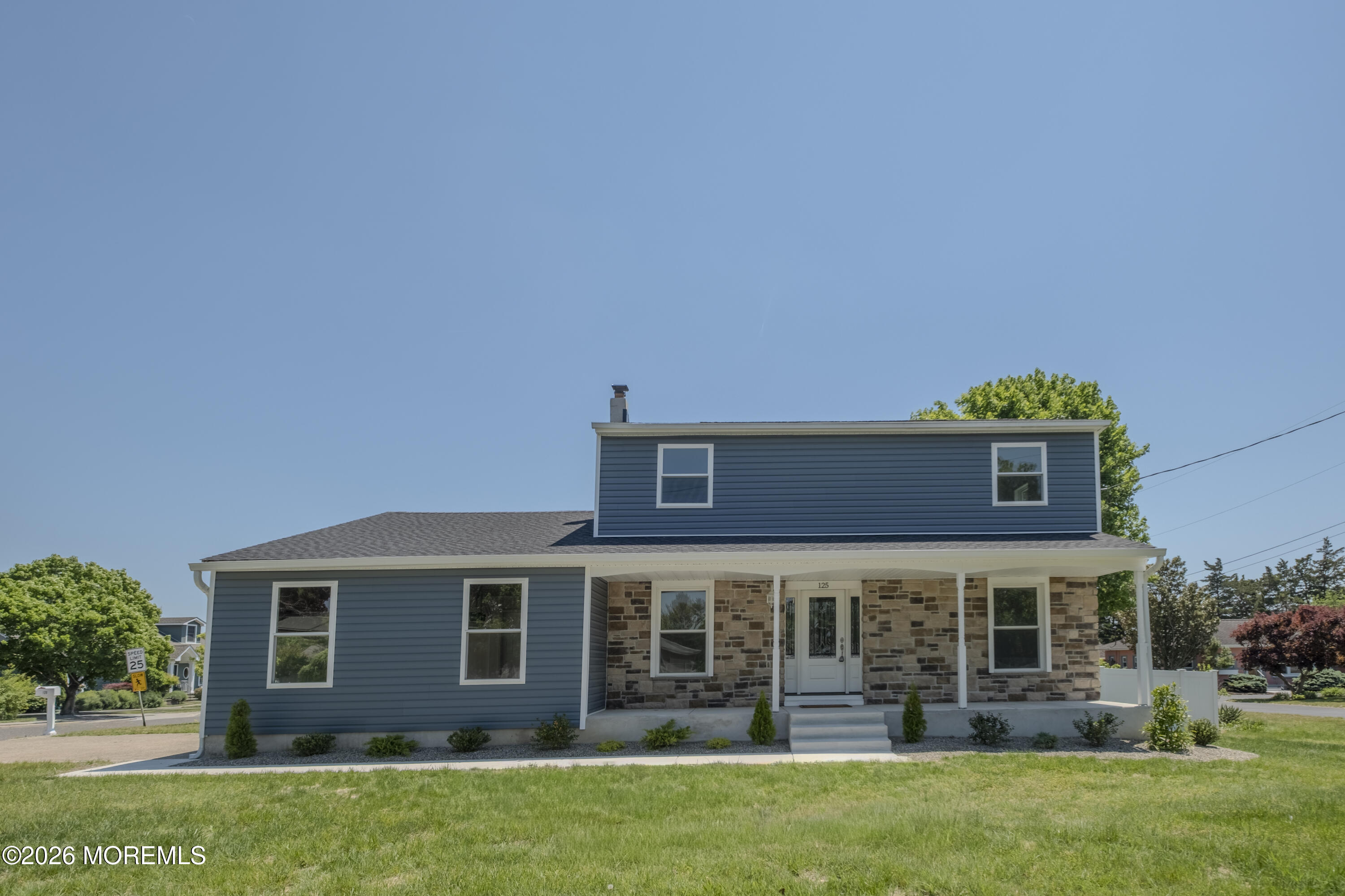 125 N Shore Road