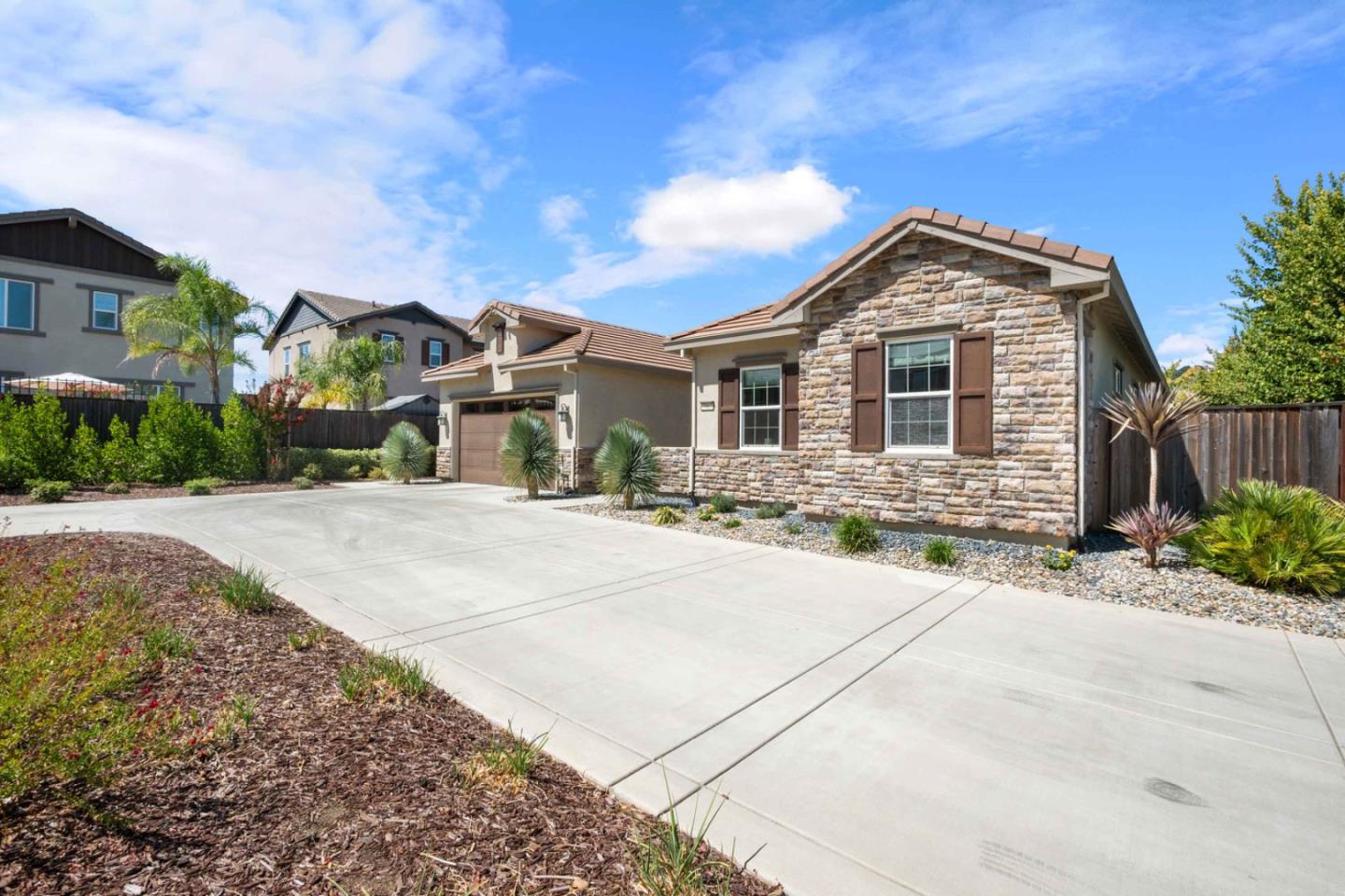 7887 Cumin CT