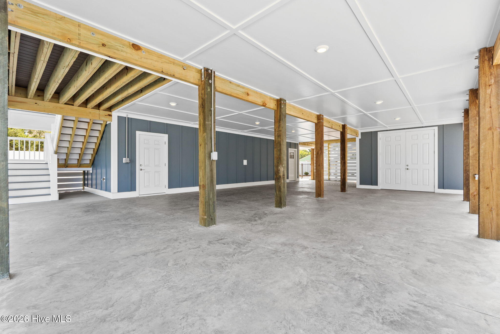 108 NE 64th Street