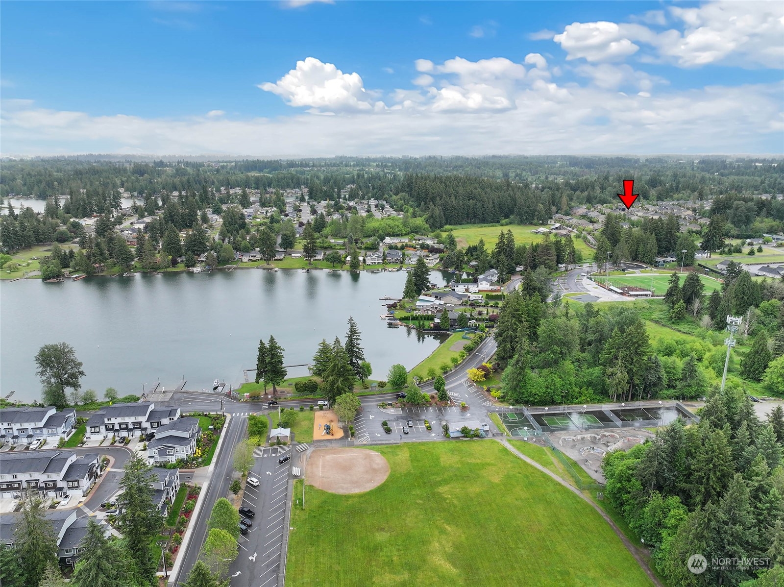 20302 77th Street Ct E