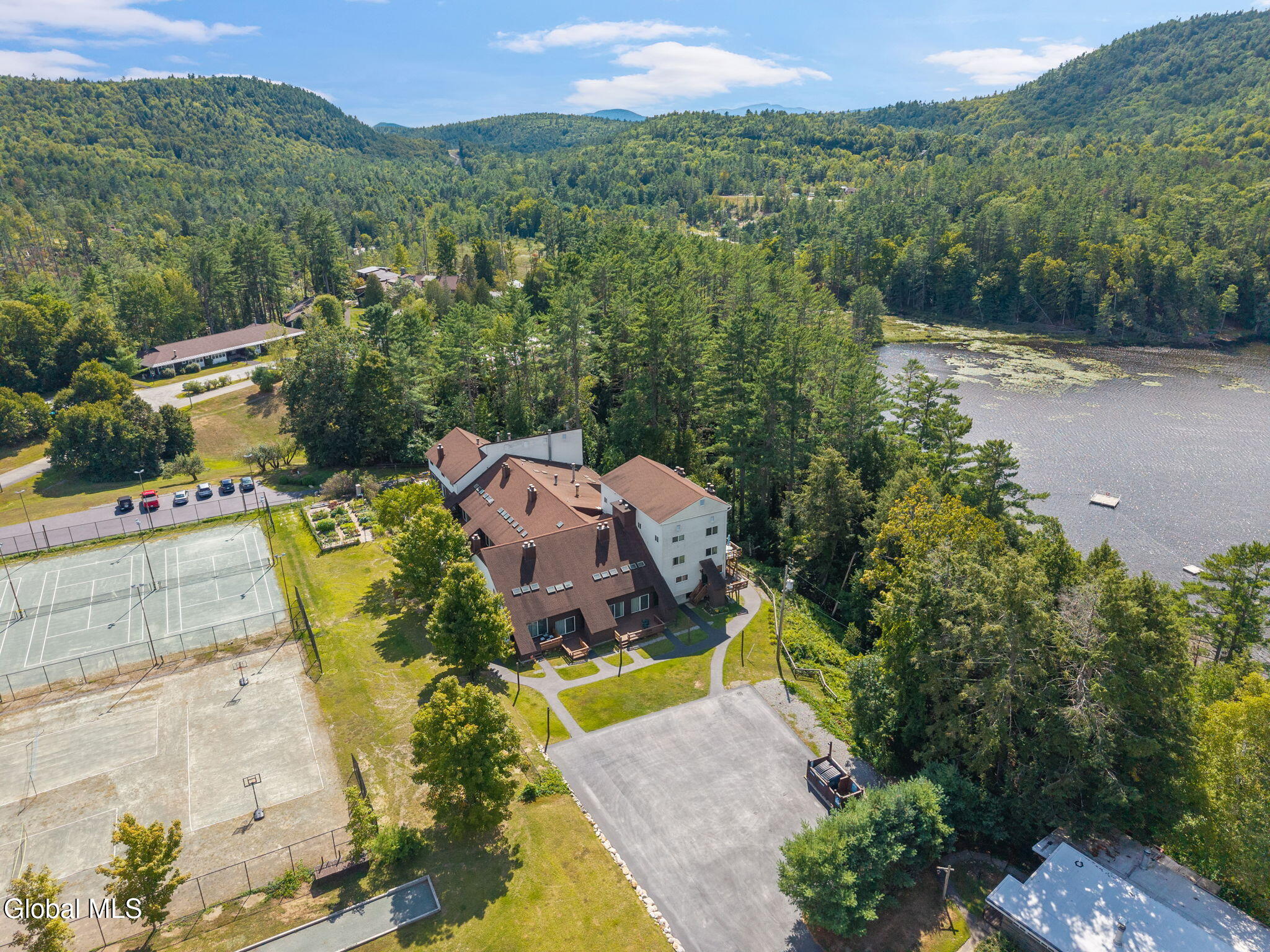 11 N Overlook Lane, L