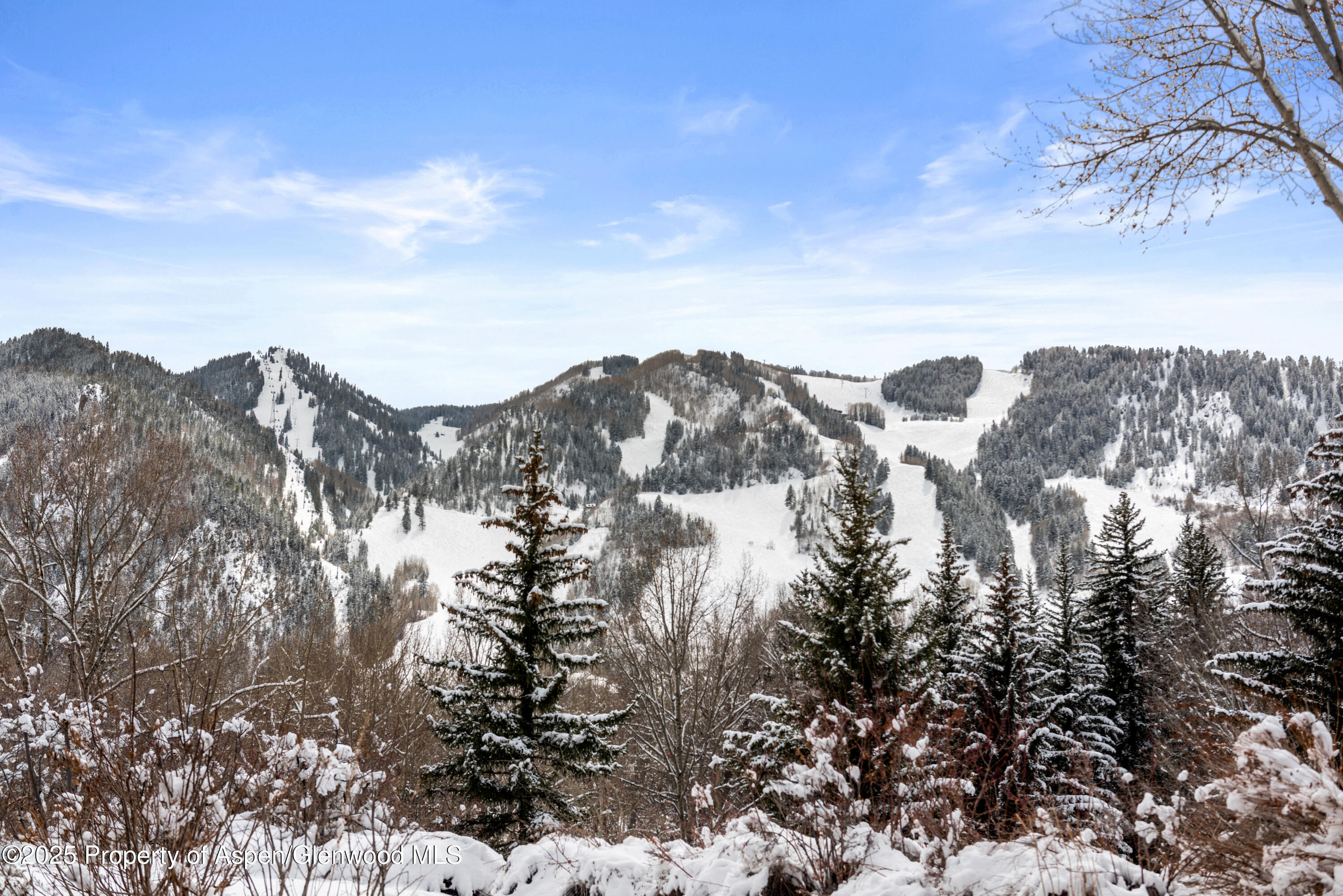 155 Lone Pine Road 5