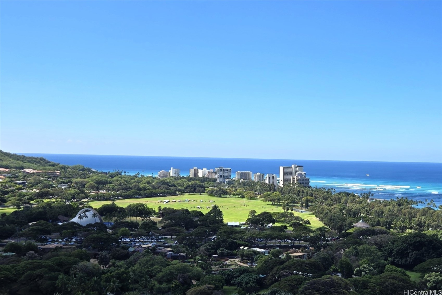 2600 Pualani Way 3102